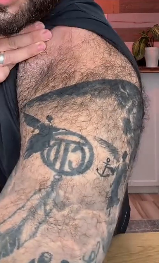 Hairy upper arm before